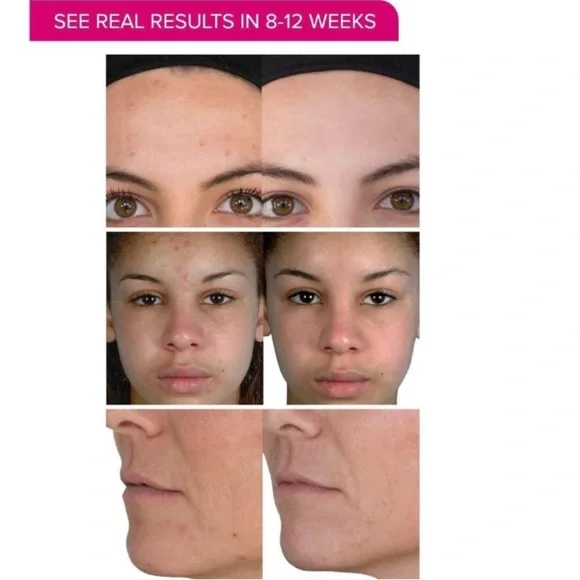 PMD Personal Microderm - Picture 5 of 6